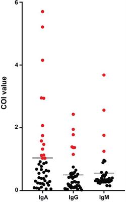 Detection of SARS-CoV-2 Specific Antibodies in Saliva Samples